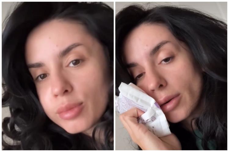 Influencerița clujeană Ioana Grama, de nerecunoscut! Ce probleme medicale nu îi dau pace: ,,Nu pot să vă descriu durerea pe care am simțit-o” 